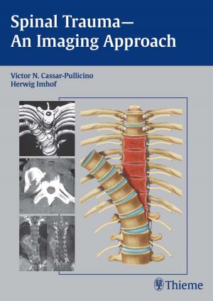 Cover of the book Spinal Trauma - An Imaging Approach by Gisela Meier, Johannes Buettner