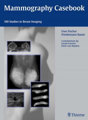 Cover of the book Mammography Casebook by Jeffrey Roth, William Hughes
