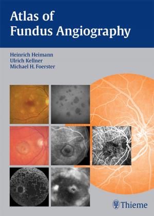 Cover of the book Atlas of Fundus Angiography by David Goldenberg, Bradley J. Goldstein
