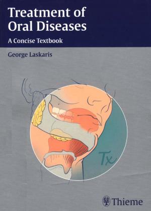 Cover of the book Treatment of Oral Diseases by Jaime Tisnado, Philip C. Pieters, Matthew A. Mauro