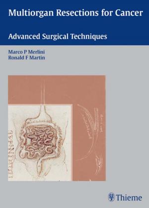 Cover of the book Multiorgan Resections for Cancer by 