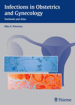 Book cover of Infections in Obstetrics and Gynecology