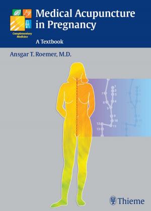 Cover of the book Medical Acupuncture in Pregnancy by Joseph Eldor