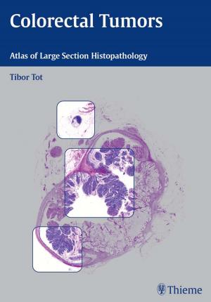Book cover of Colorectal Tumors