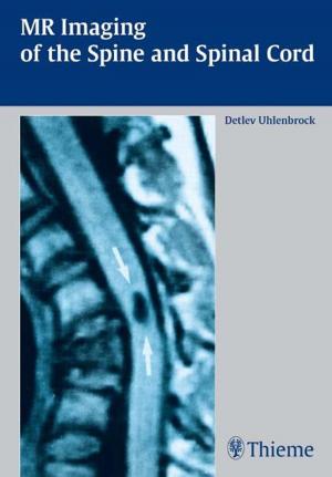 Cover of the book MR Imaging of the Spine and Spinal Cord by Francoise Wilhelmi de Toledo, Hubert Hohler