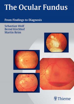 Book cover of Ocular Fundus