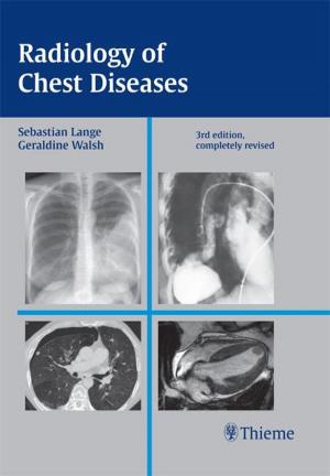 Cover of the book Radiology of Chest Diseases by Manfred Thelen, Raimund Erbel, Karl-Friedrich Kreitner