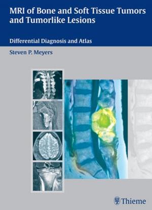 Cover of the book MRI of Bone and Soft Tissue Tumors and Tumorlike Lesions by E. Sander Connolly, Guy M. McKhann II, Judy Huang