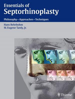 Book cover of Essentials of Septorhinoplasty
