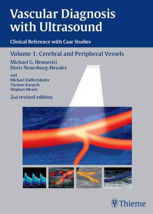 Book cover of Vascular Diagnosis with Ultrasound