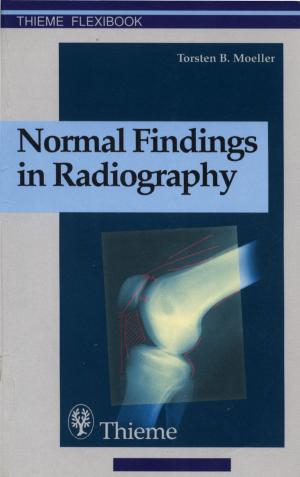 Cover of the book Normal Findings in Radiography by Kern Singh, Alexander R. Vaccaro