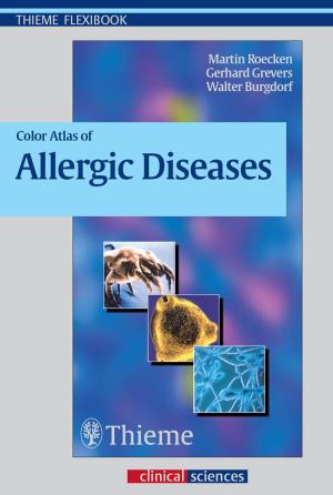 Cover of the book Color Atlas of Allergic Diseases by Michael Schuenke, Erik Schulte, Udo Schumacher