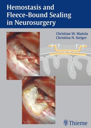 Cover of the book Hemostasis and Fleece-Bound Sealing in Neurosurgery by Daniel Appelbaum, John Miliziano, Yong Bradley