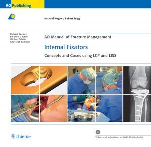 Cover of the book AO Manual of Fracture Management: Internal Fixators by Guenter Schmidt, Lucas Greiner, Dieter Nuernberg