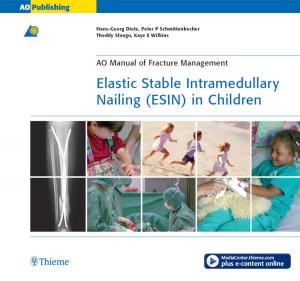 Cover of the book Elastic Stable Intramedullary Nailing (ESIN) in Children by Mario Sanna, Fernando Mancini