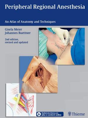 Book cover of Peripheral Regional Anesthesia