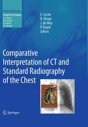 Cover of the book Comparative Interpretation of CT and Standard Radiography of the Chest by Magdalena Gromada, Gennady Mishuris, Andreas Öchsner