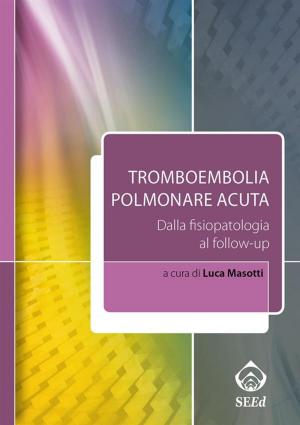 Cover of the book Tromboembolia polmonare acuta by Lorenzo Pradelli, Albert Wertheimer