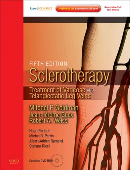 Cover of the book Sclerotherapy E-Book by Mitchel P. Goldman, MD, Robert A Weiss, MD, Elsevier Health Sciences