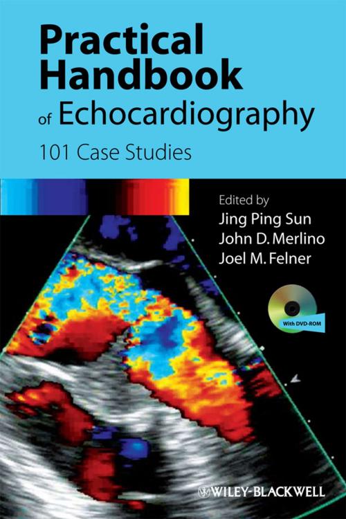 Cover of the book Practical Handbook of Echocardiography by , Wiley