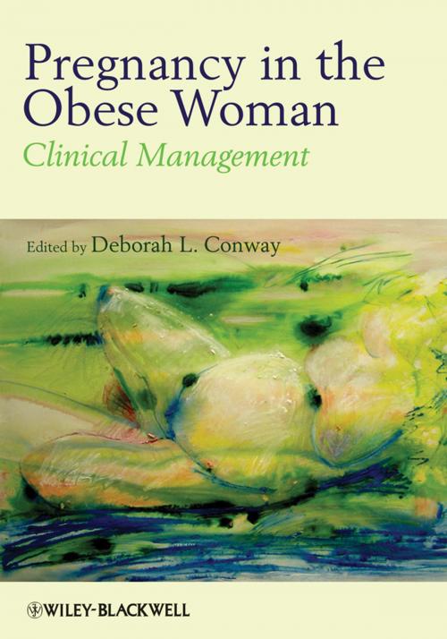 Cover of the book Pregnancy in the Obese Woman by , Wiley