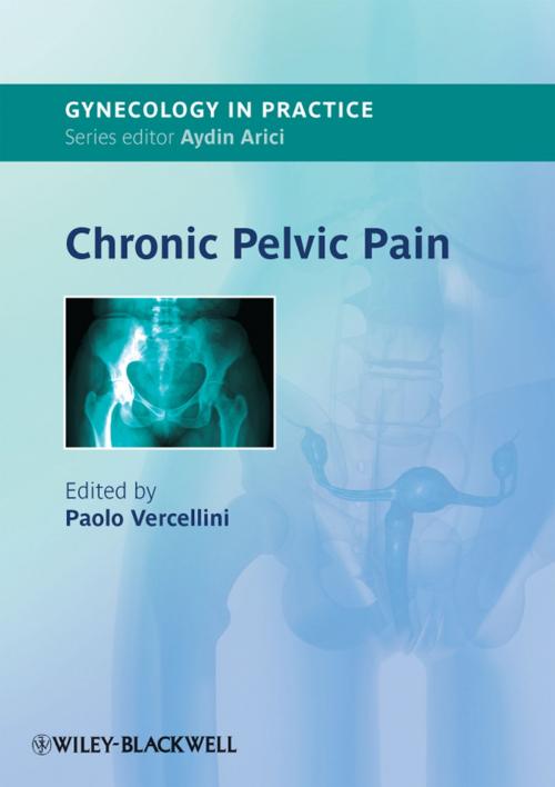 Cover of the book Chronic Pelvic Pain by , Wiley