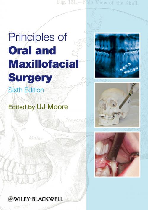 Cover of the book Principles of Oral and Maxillofacial Surgery by U. J. Moore, Wiley
