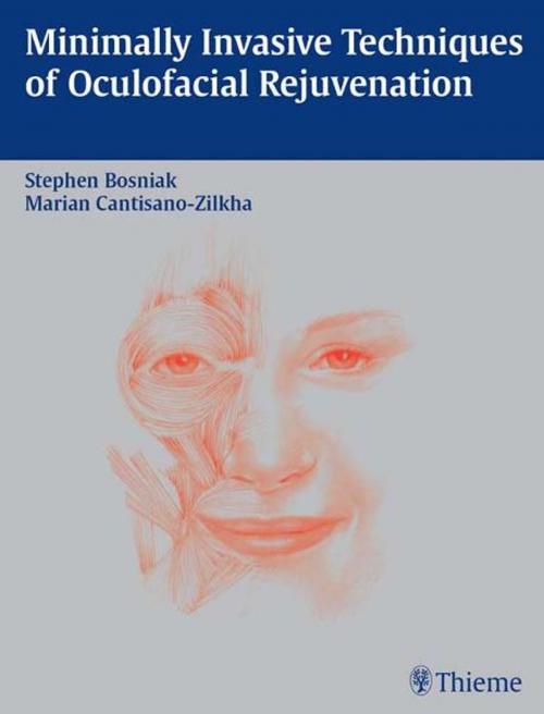 Cover of the book Minimally Invasive Techniques of Oculofacial Rejuvenation by , Thieme