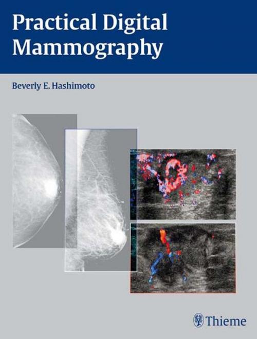 Cover of the book Practical Digital Mammography by Beverly Hashimoto, Thieme
