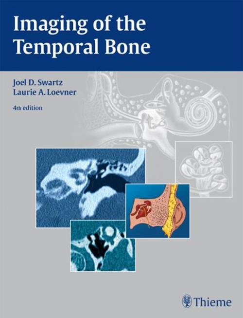 Cover of the book Imaging of the Temporal Bone by Joel D. Swartz, Laurie A. Loevner, Thieme