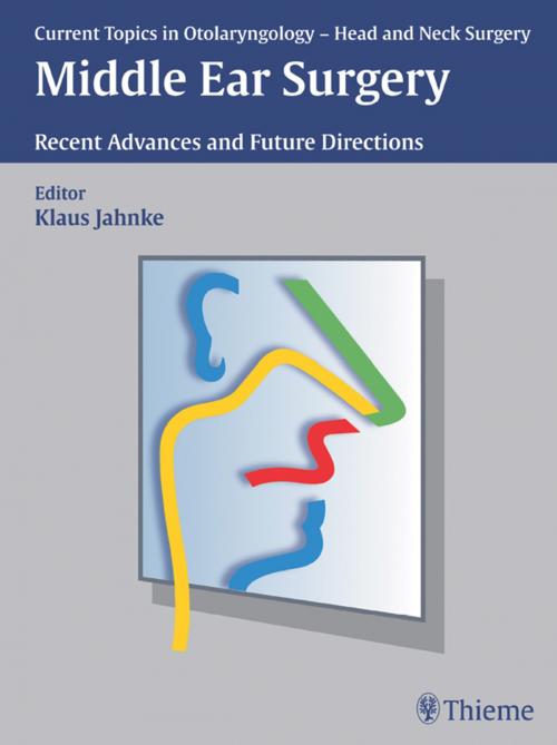 Cover of the book Middle Ear Surgery by Klaus Jahnke, Thieme