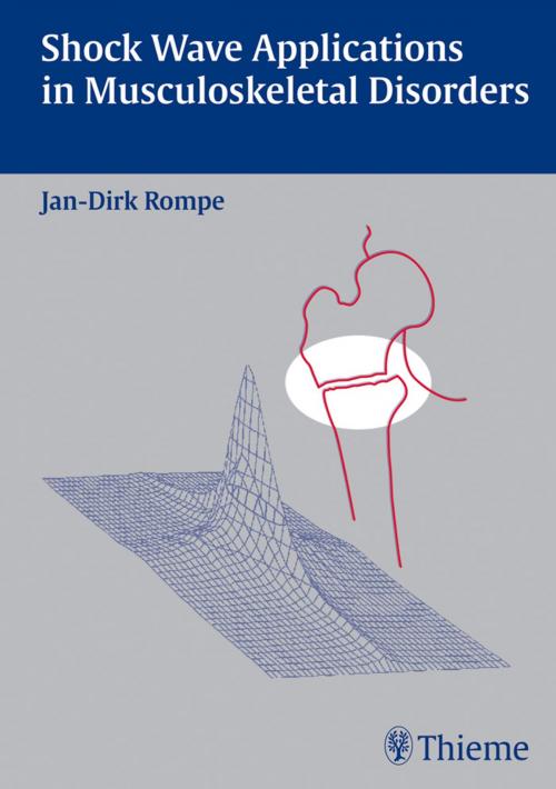 Cover of the book Shock Wave Applications in Musculoskeletal Disorders by Jan Dirk Rompe, Thieme