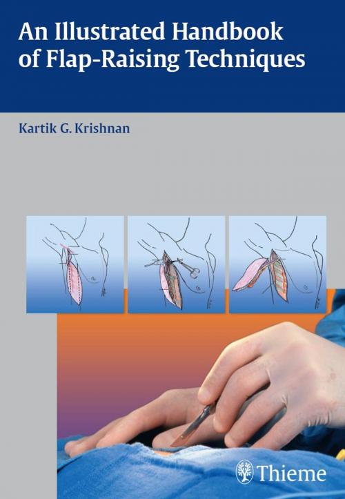 Cover of the book Illustrated Handbook of Flap-Raising Techniques by Kartik G. Krishnan, Thieme