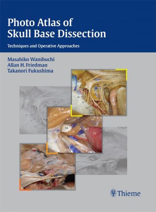Cover of the book Photo Atlas of Skull Base Dissection by Masahiko Wanibuchi, Allan H. Friedman, Takanori Fukushima, Thieme