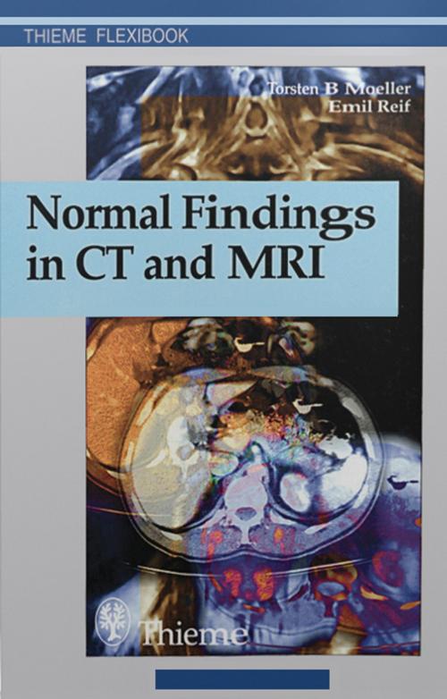 Cover of the book Normal Findings in CT and MRI by Emil Reif, Torsten Bert Moeller, Thieme