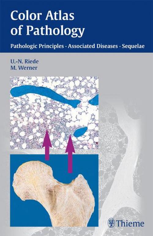 Cover of the book Color Atlas of Pathology by Ursus-Nikolaus Riede, Martin Werner, Thieme