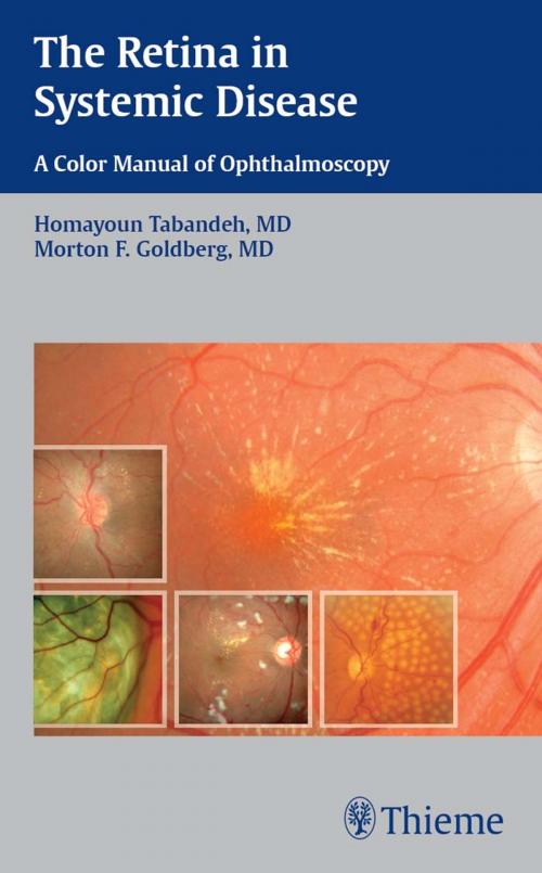 Cover of the book The Retina in Systemic Disease by Homayoun Tabandeh, Morton F. Goldberg, Thieme