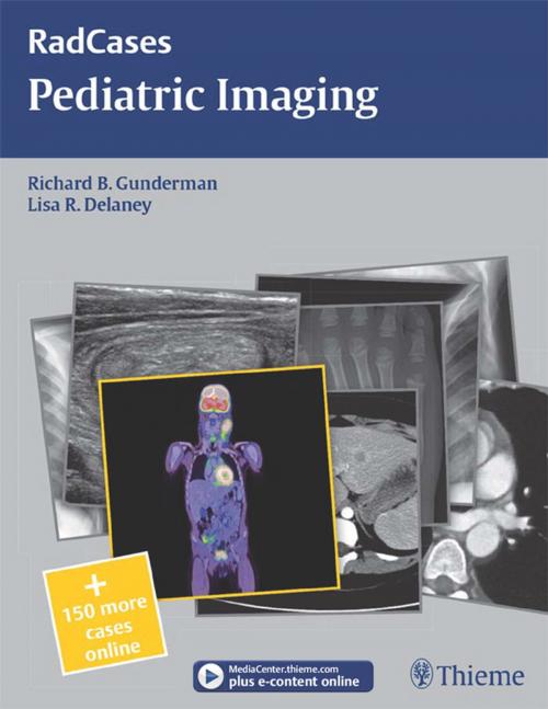 Cover of the book Pediatric Imaging by Richard B. Gunderman, Lisa R. Delaney, Thieme