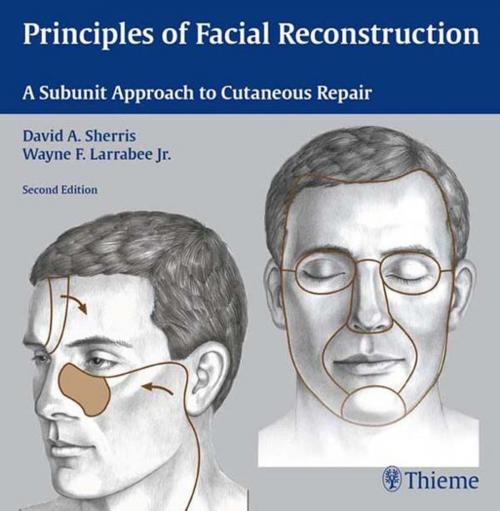 Cover of the book Principles of Facial Reconstruction by , Thieme