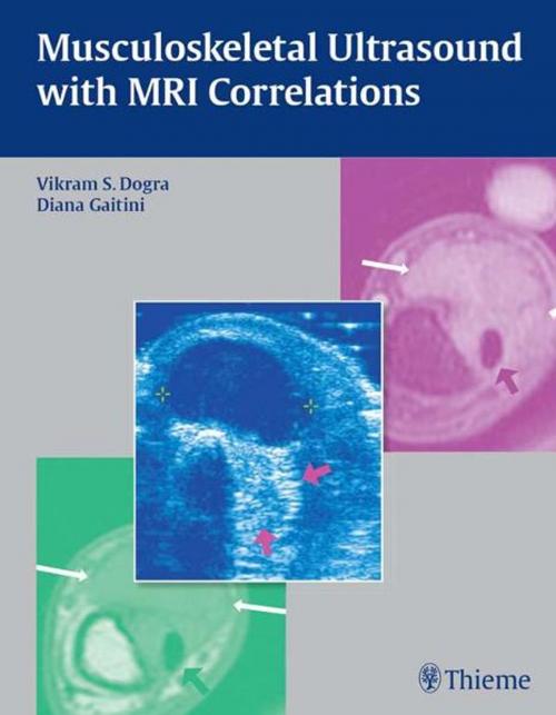 Cover of the book Musculoskeletal Ultrasound with MRI Correlations by , Thieme