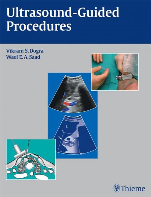 Cover of the book Ultrasound-Guided Procedures by Vikram S. Dogra, Wael E. A. Saad, Thieme