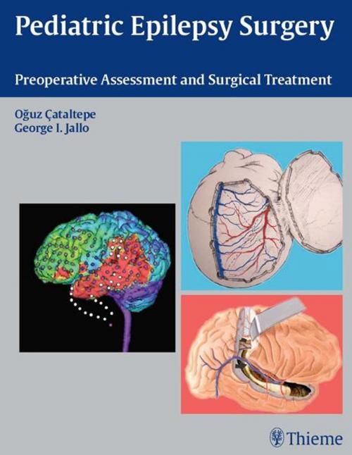 Cover of the book Pediatric Epilepsy Surgery by , Thieme