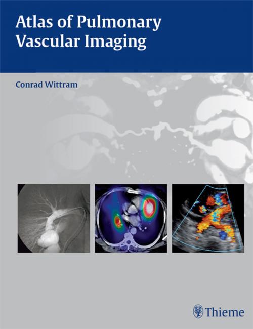 Cover of the book Atlas of Pulmonary Vascular Imaging by Conrad Wittram, Thieme
