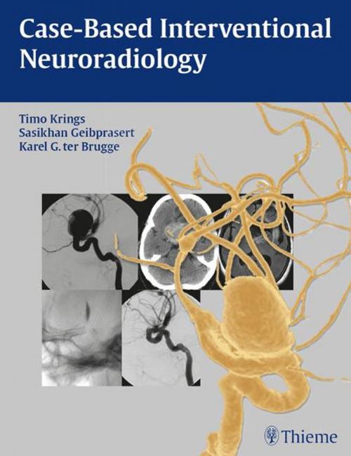 Cover of the book Case-Based Interventional Neuroradiology by Timo Krings, Sasikhan Geibprasert, Karel ter Brugge, Thieme