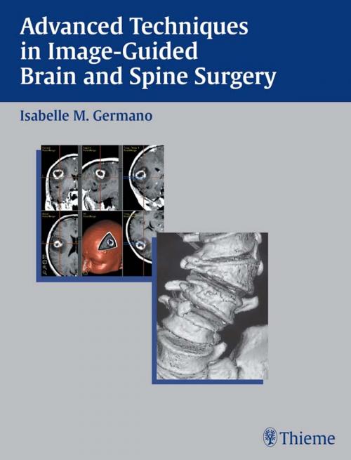 Cover of the book Advanced Techniques in Image-Guided Brain and Spine Surgery by Isabelle M. Germano, Thieme