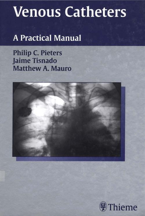 Cover of the book Venous Catheters by Jaime Tisnado, Philip C. Pieters, Matthew A. Mauro, Thieme