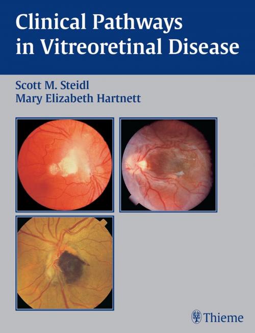 Cover of the book Clinical Pathways In Vitreoretinal Disease by , Thieme