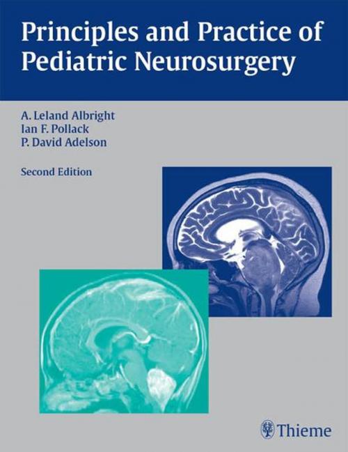 Cover of the book Principles and Practice of Pediatric Neurosurgery by A. Leland Albright, Ian F. Pollack, P. David Adelson, Thieme