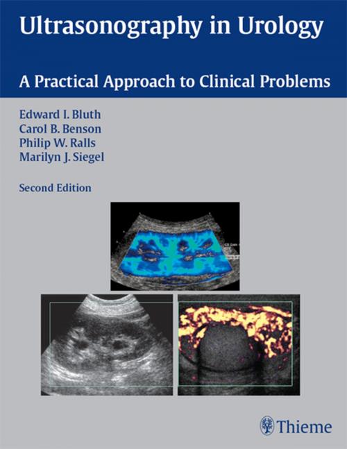 Cover of the book Ultrasonography in Urology by Edward I. Bluth, Carol B. Benson, Philip W. Ralls, Thieme
