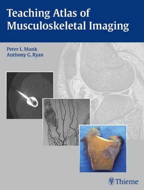 Cover of the book Teaching Atlas of Musculoskeletal Imaging by , Thieme
